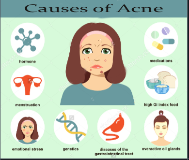 how to shrink a cystic pimple