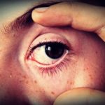 red spot on skin under eye