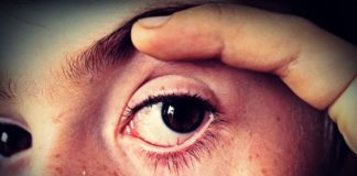 red spot on skin under eye