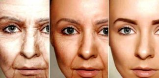normal skin changes with aging
