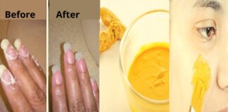 How to Remove Turmeric Stains from Skin