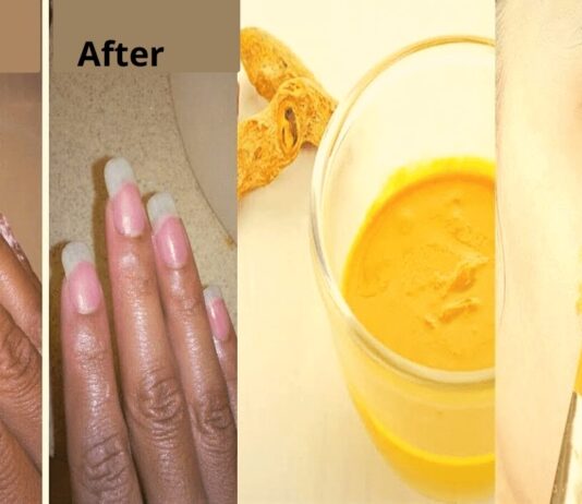 How to Remove Turmeric Stains Easily from Skin How to Remove Turmeric Stains from Skin