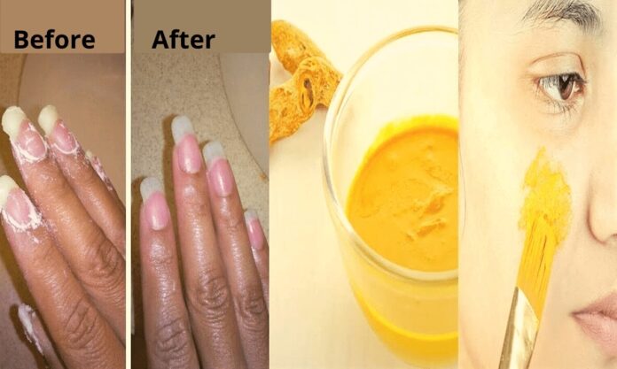 How to Remove Turmeric Stains from Skin