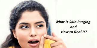 What Is Skin Purging and How to Deal It?