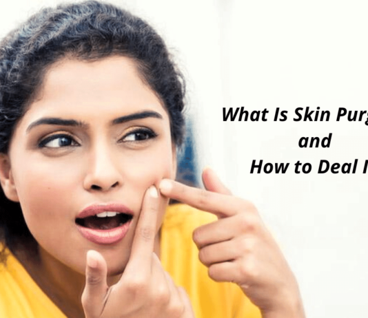 What Is Skin Purging and How to Deal It? What Is Skin Purging and How to Deal It?